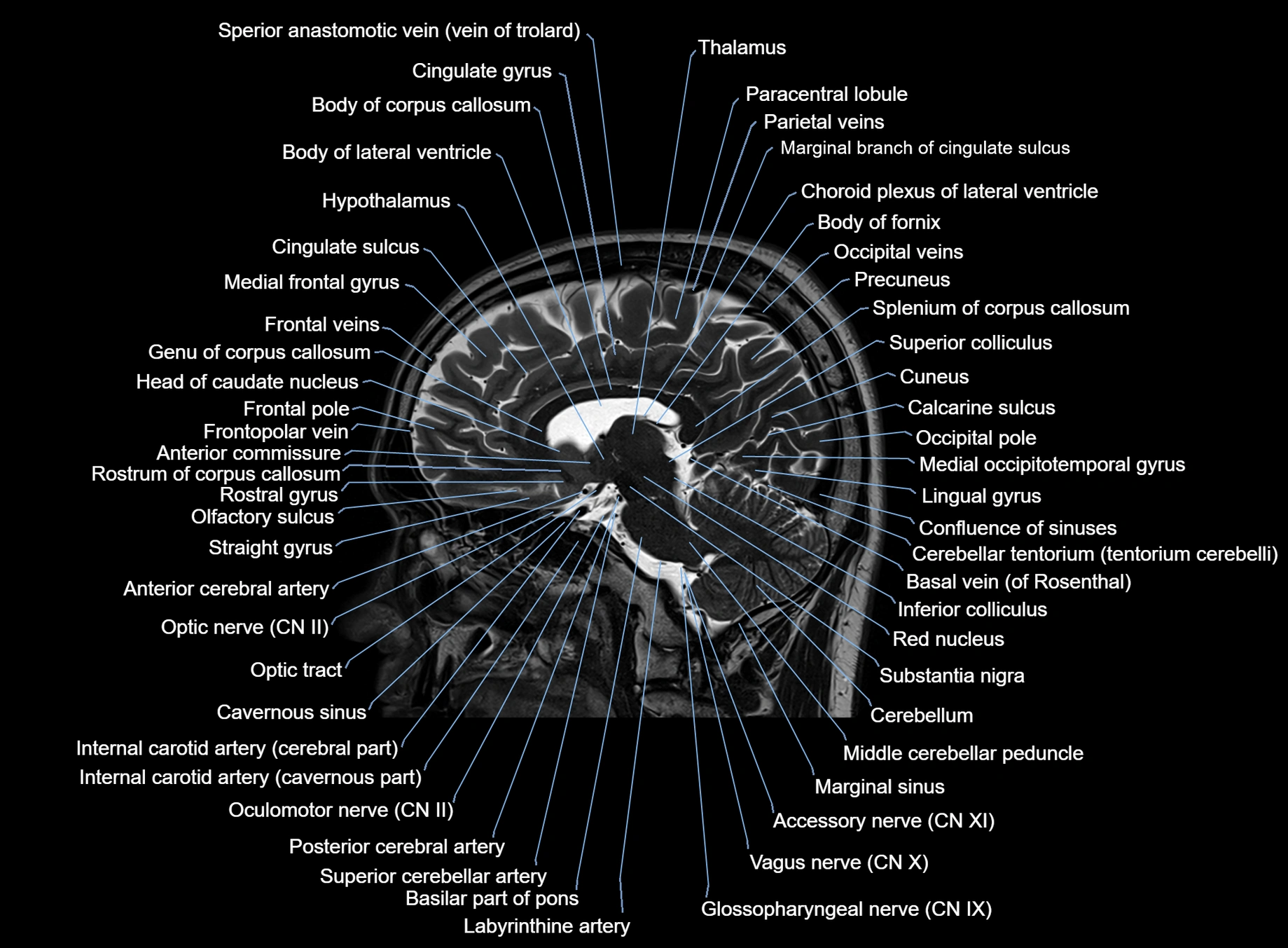 brain sagittal anatomy 3T MRI images -img-00001-00030.webp